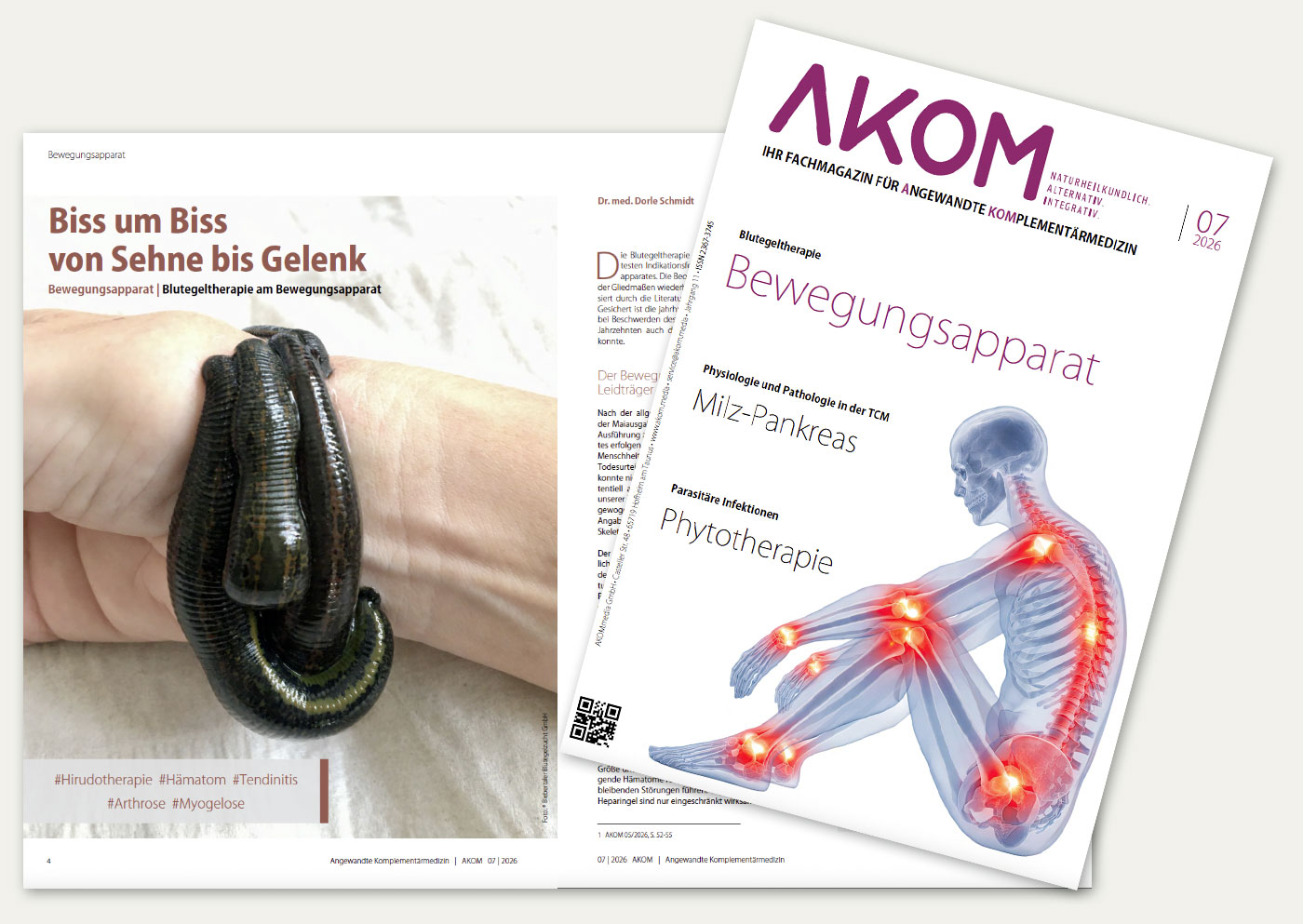 bi 2510 Artikel Therapie bbi dezember 2025 blutegeltherapie 1400